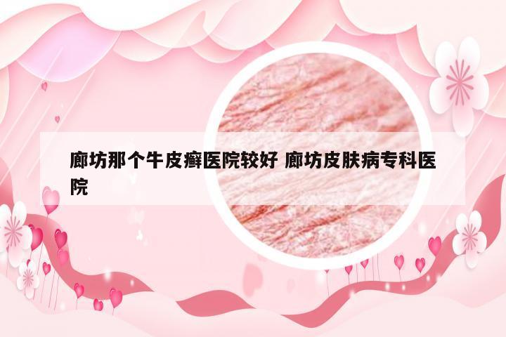 廊坊那个牛皮癣医院较好 廊坊皮肤病专科医院