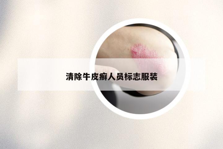 清除牛皮癣人员标志服装