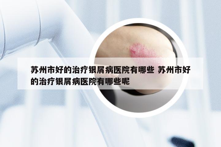 苏州市好的治疗银屑病医院有哪些 苏州市好的治疗银屑病医院有哪些呢