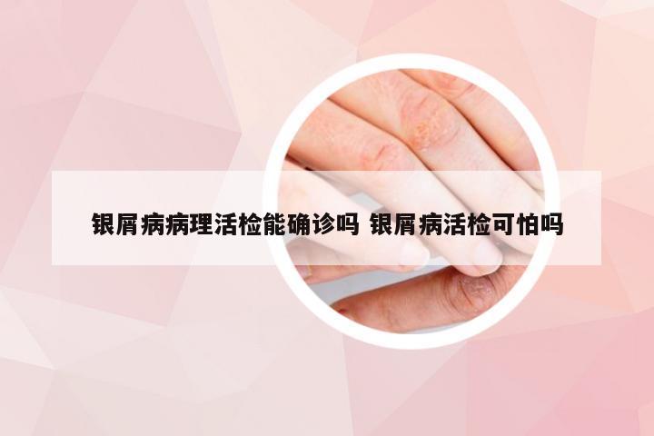 银屑病病理活检能确诊吗 银屑病活检可怕吗