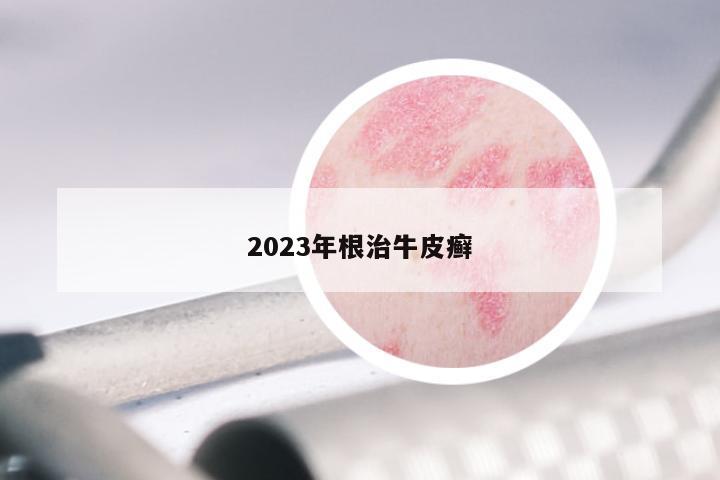 2023年根治牛皮癣
