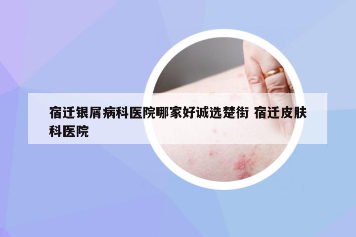 宿迁银屑病科医院哪家好诚选楚街 宿迁皮肤科医院