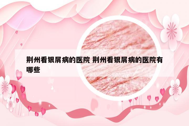 荆州看银屑病的医院 荆州看银屑病的医院有哪些