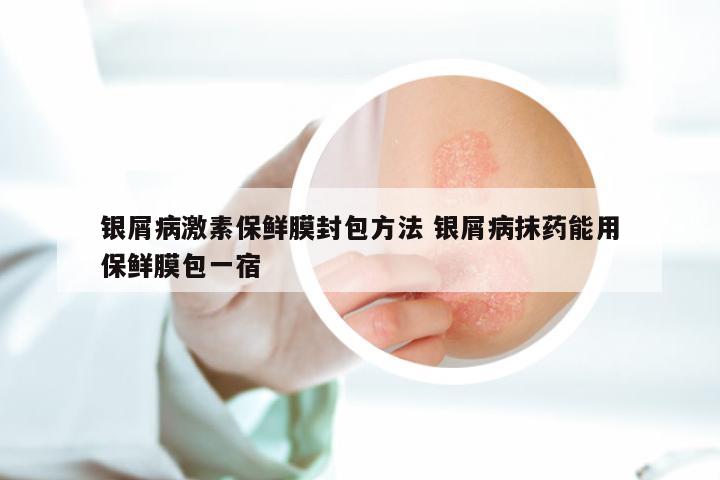 银屑病激素保鲜膜封包方法 银屑病抹药能用保鲜膜包一宿