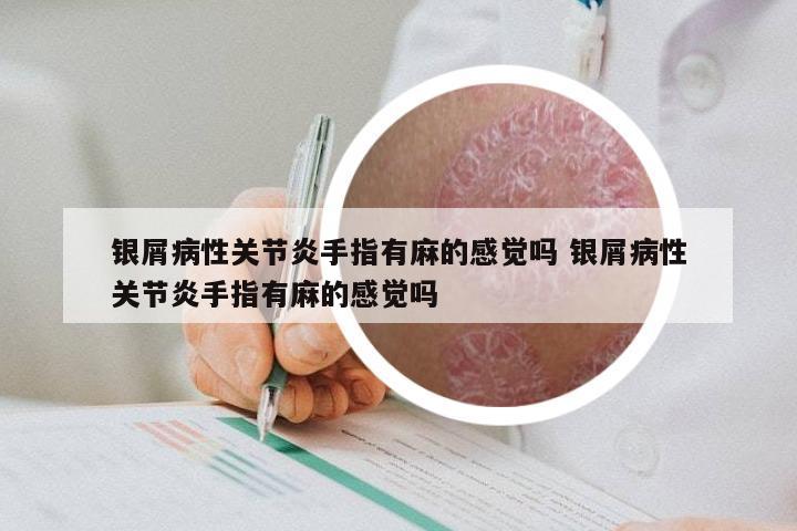 银屑病性关节炎手指有麻的感觉吗 银屑病性关节炎手指有麻的感觉吗