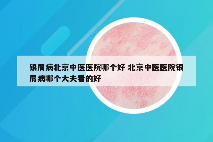 银屑病北京中医医院哪个好 北京中医医院银屑病哪个大夫看的好