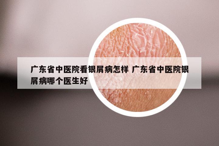 广东省中医院看银屑病怎样 广东省中医院银屑病哪个医生好