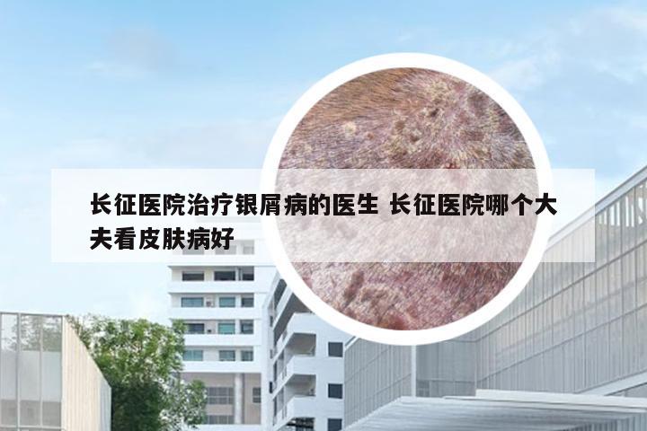 长征医院治疗银屑病的医生 长征医院哪个大夫看皮肤病好
