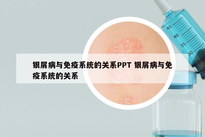 银屑病与免疫系统的关系PPT 银屑病与免疫系统的关系