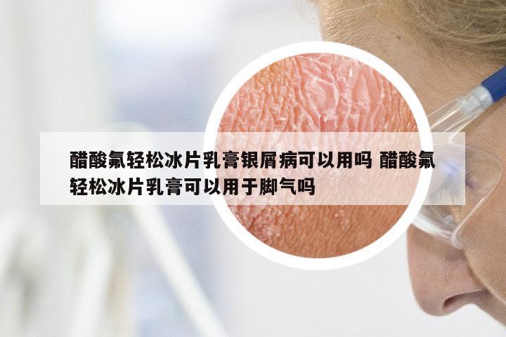 醋酸氟轻松冰片乳膏银屑病可以用吗 醋酸氟轻松冰片乳膏可以用于脚气吗