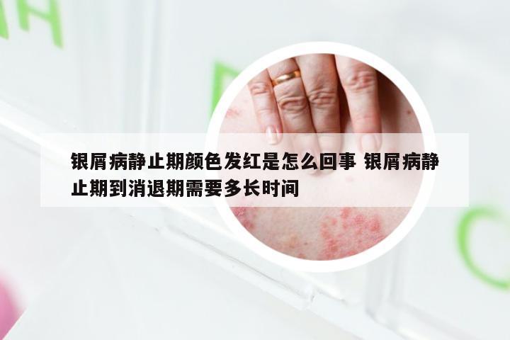 银屑病静止期颜色发红是怎么回事 银屑病静止期到消退期需要多长时间