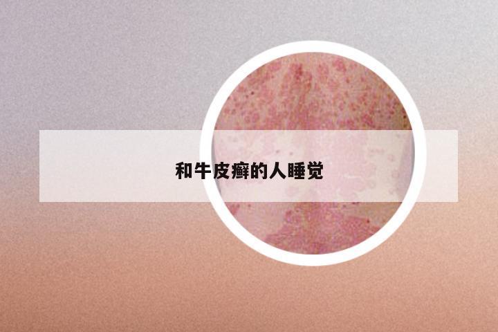 和牛皮癣的人睡觉