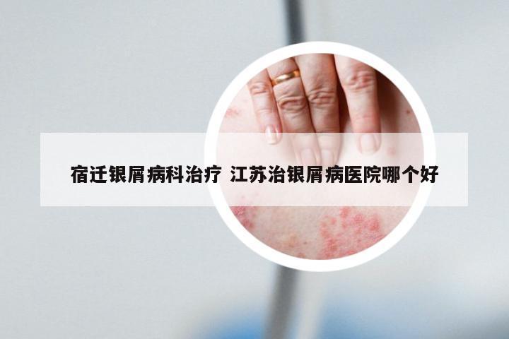 宿迁银屑病科治疗 江苏治银屑病医院哪个好