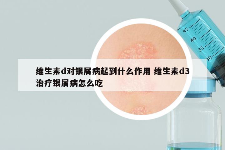 维生素d对银屑病起到什么作用 维生素d3治疗银屑病怎么吃