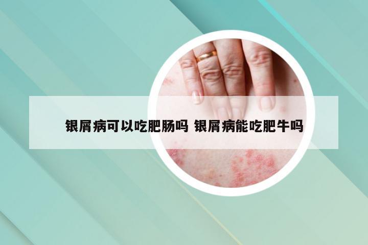 银屑病可以吃肥肠吗 银屑病能吃肥牛吗
