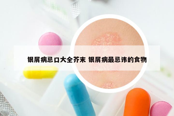 银屑病忌口大全芥末 银屑病最忌讳的食物