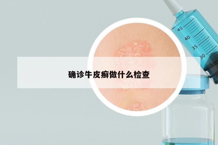 确诊牛皮癣做什么检查