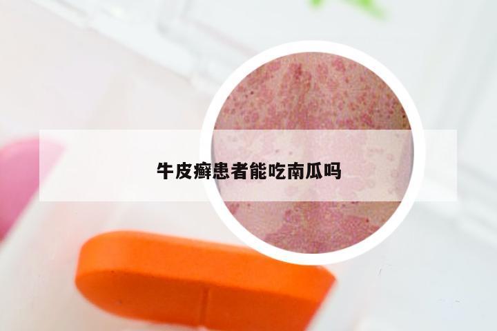 牛皮癣患者能吃南瓜吗