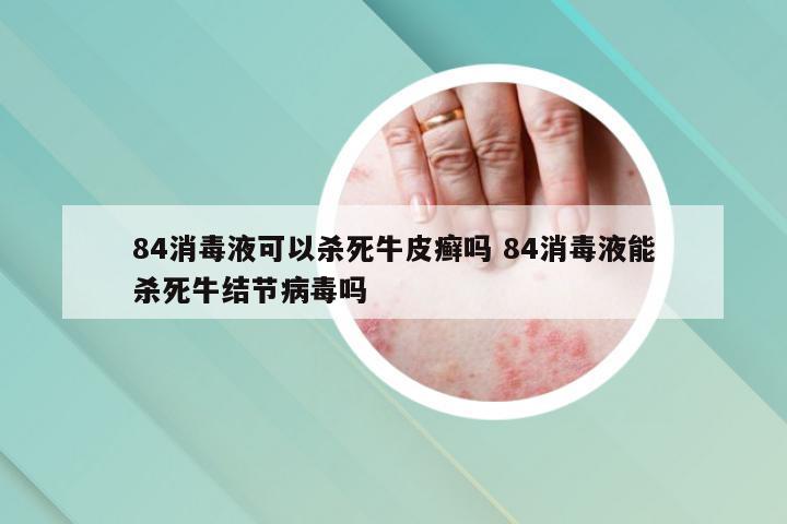 84消毒液可以杀死牛皮癣吗 84消毒液能杀死牛结节病毒吗