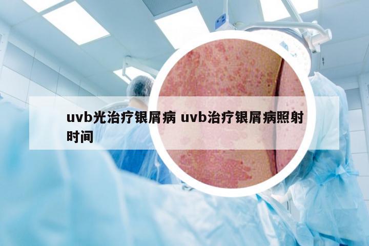 uvb光治疗银屑病 uvb治疗银屑病照射时间