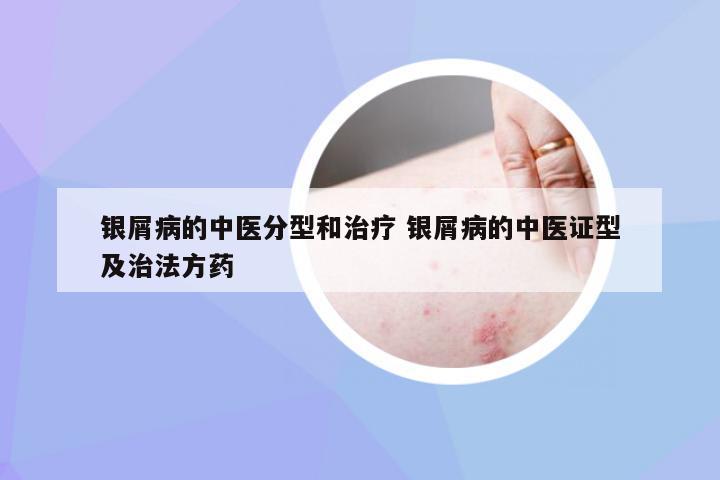 银屑病的中医分型和治疗 银屑病的中医证型及治法方药