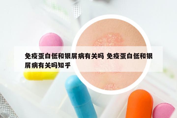 免疫蛋白低和银屑病有关吗 免疫蛋白低和银屑病有关吗知乎