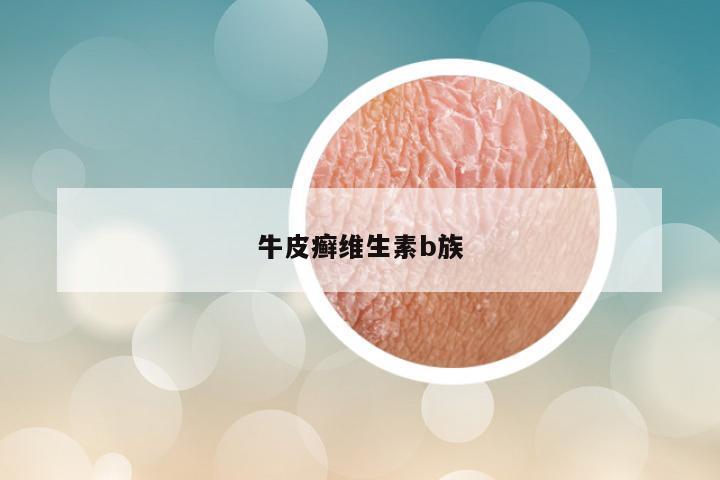 牛皮癣维生素b族