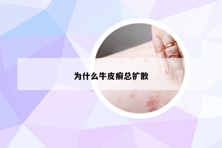 为什么牛皮癣总扩散