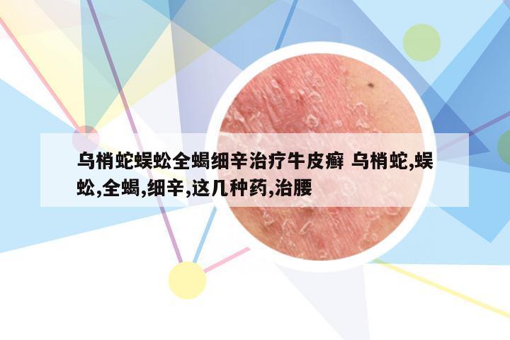 乌梢蛇蜈蚣全蝎细辛治疗牛皮癣 乌梢蛇,蜈蚣,全蝎,细辛,这几种药,治腰