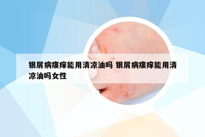 银屑病瘙痒能用清凉油吗 银屑病瘙痒能用清凉油吗女性