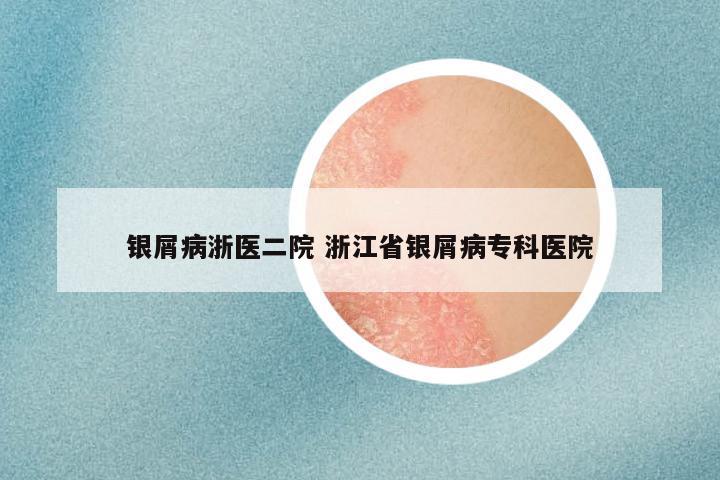 银屑病浙医二院 浙江省银屑病专科医院