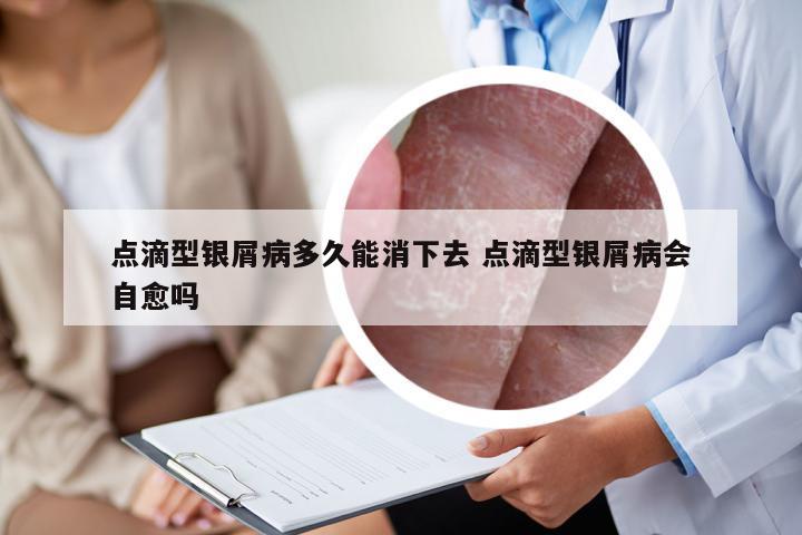 点滴型银屑病多久能消下去 点滴型银屑病会自愈吗