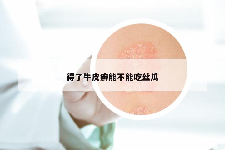 得了牛皮癣能不能吃丝瓜