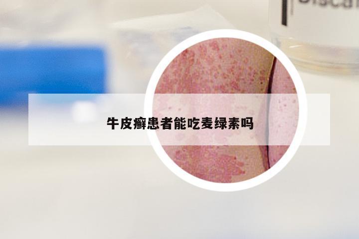 牛皮癣患者能吃麦绿素吗