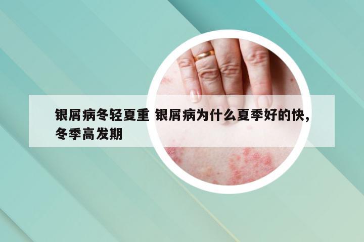 银屑病冬轻夏重 银屑病为什么夏季好的快,冬季高发期