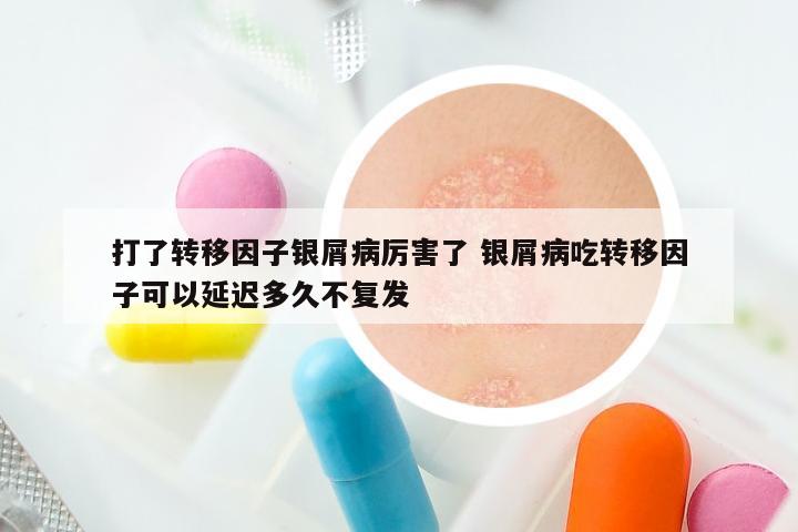 打了转移因子银屑病厉害了 银屑病吃转移因子可以延迟多久不复发
