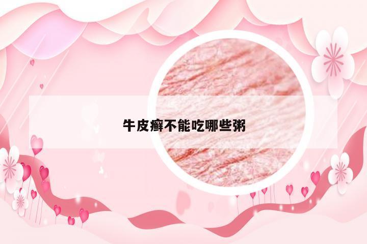 牛皮癣不能吃哪些粥