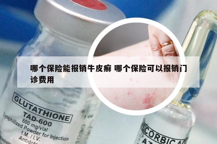 哪个保险能报销牛皮癣 哪个保险可以报销门诊费用