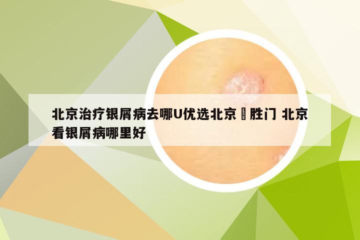 北京治疗银屑病去哪U优选北京徳胜门 北京看银屑病哪里好