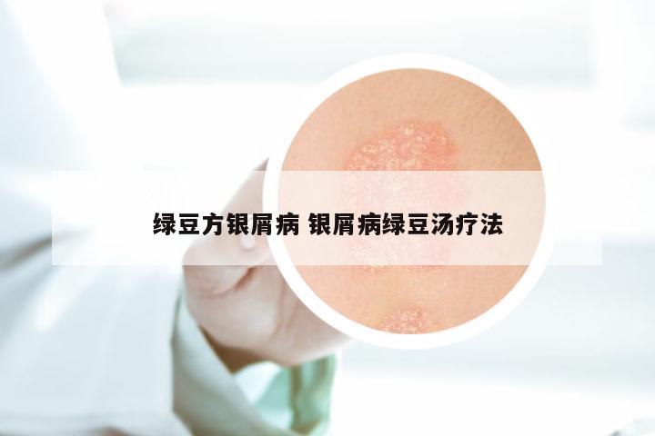 绿豆方银屑病 银屑病绿豆汤疗法