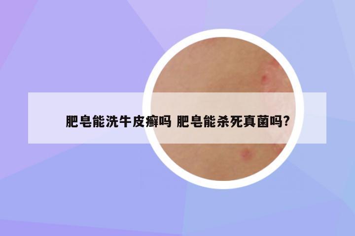 肥皂能洗牛皮癣吗 肥皂能杀死真菌吗?