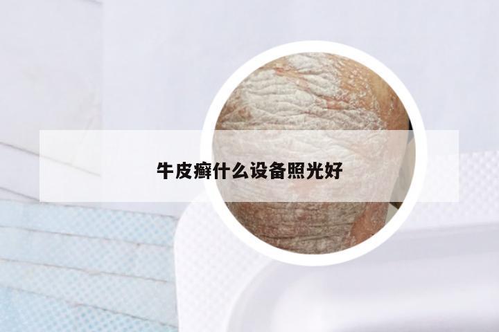 牛皮癣什么设备照光好