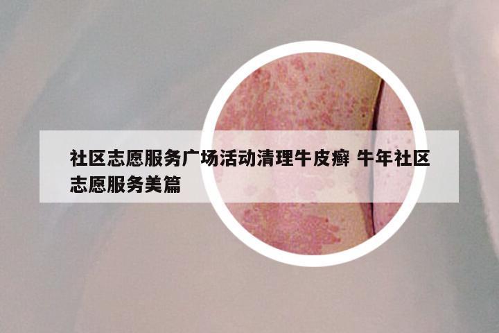 社区志愿服务广场活动清理牛皮癣 牛年社区志愿服务美篇