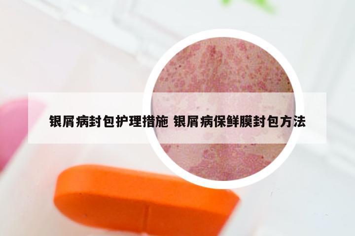 银屑病封包护理措施 银屑病保鲜膜封包方法