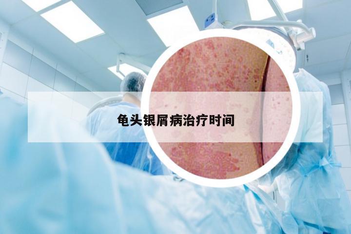 龟头银屑病治疗时间