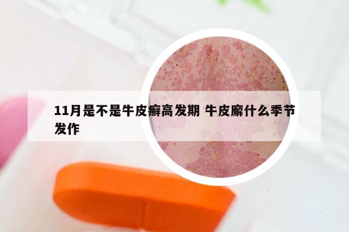 11月是不是牛皮癣高发期 牛皮廨什么季节发作