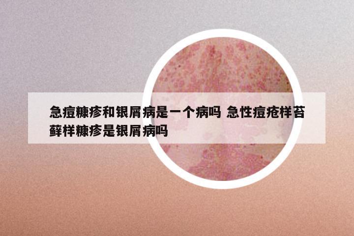 急痘糠疹和银屑病是一个病吗 急性痘疮样苔藓样糠疹是银屑病吗