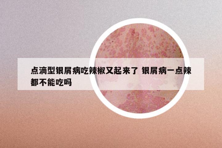 点滴型银屑病吃辣椒又起来了 银屑病一点辣都不能吃吗