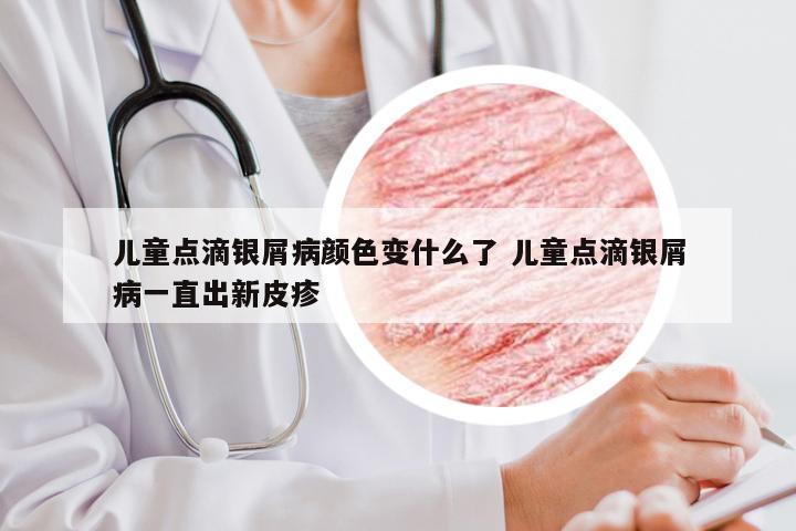 儿童点滴银屑病颜色变什么了 儿童点滴银屑病一直出新皮疹