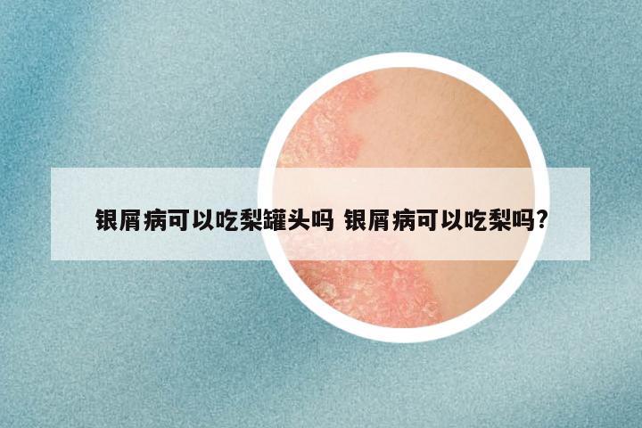 银屑病可以吃梨罐头吗 银屑病可以吃梨吗?